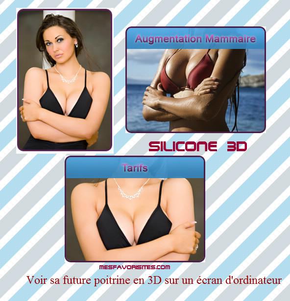 SILICONE-3D 2